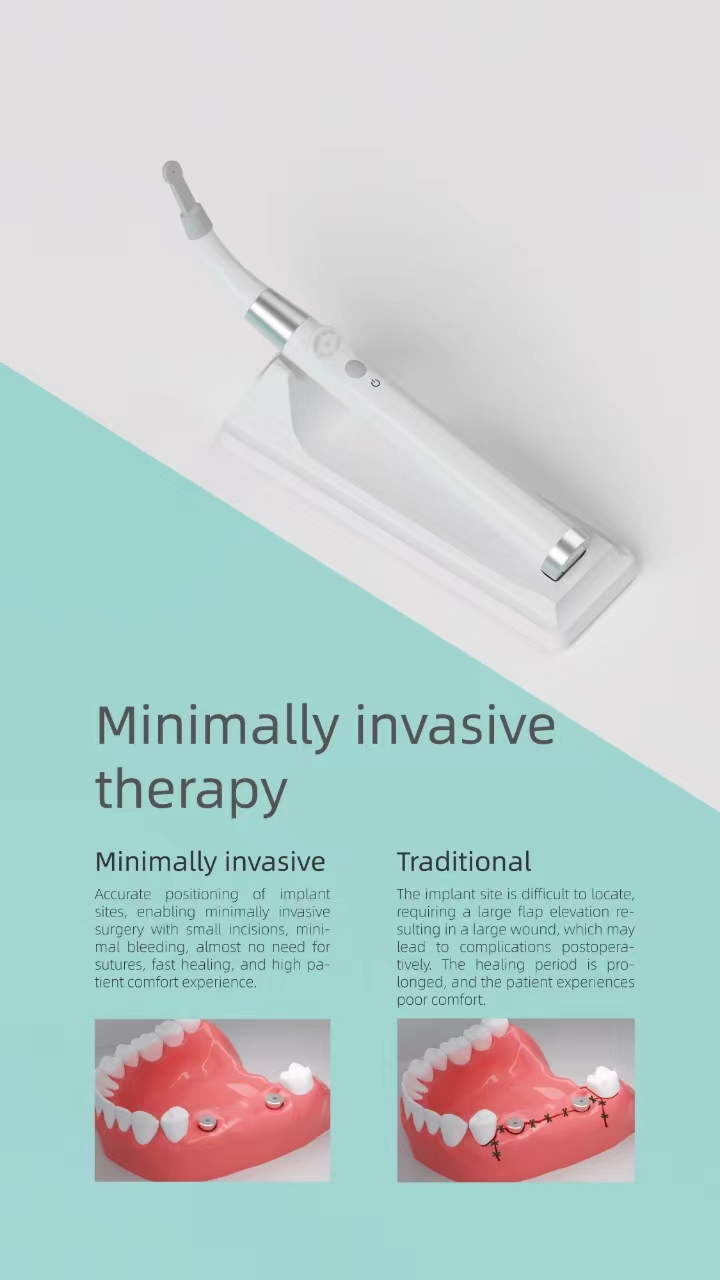 IMPLANTLOCATOR04