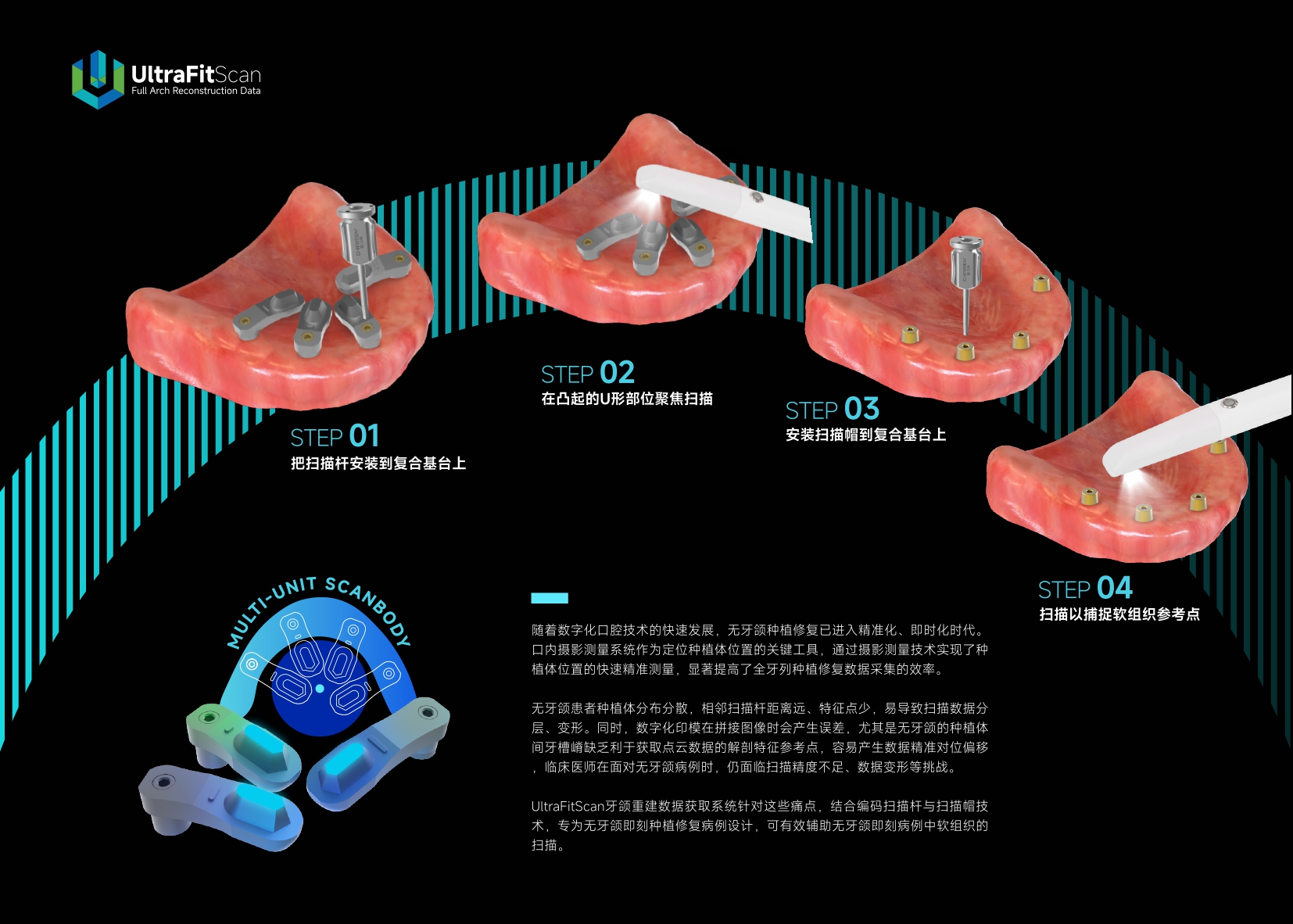 智立能-UltraFitScan-无牙颌扫描-2026-01-15_page-0002.jpg